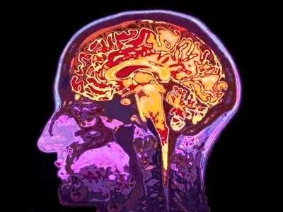۵ راهکار ساده و مفید که مغزتان سالم و جوان بماند