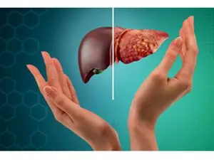 دو دارویی که هم به کبد آسیب می زند هم به کلیه
