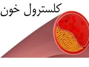 میوه‌ای مفید برای کاهش «کلسترول بد»