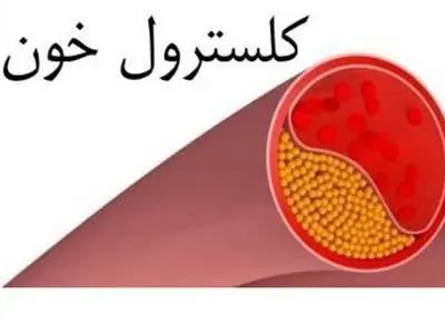 میوه‌ای مفید برای کاهش «کلسترول بد»