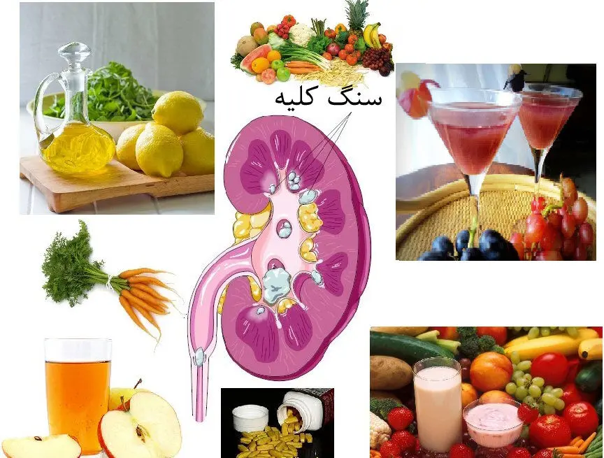 میوه‌هایی برای از بین بردن سنگ کلیه