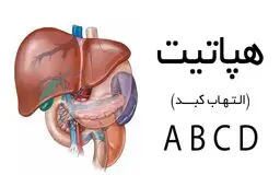 مراقب علائم هپاتیت باشید!