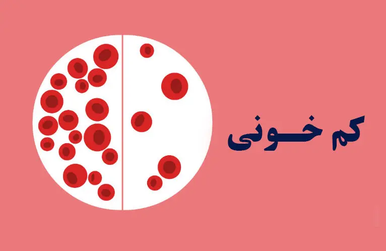 درمان کم‌خونی ، بدون دارو