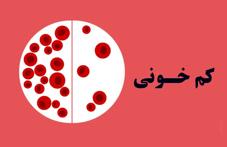 درمان کم‌خونی ، بدون دارو