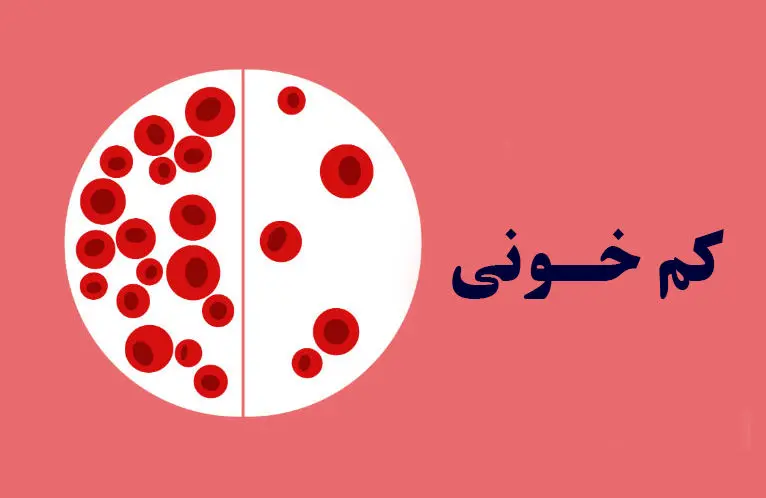 درمان کم‌خونی ، بدون دارو