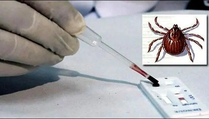 تب کریمه چطور باعث مرگ می‌شود؟