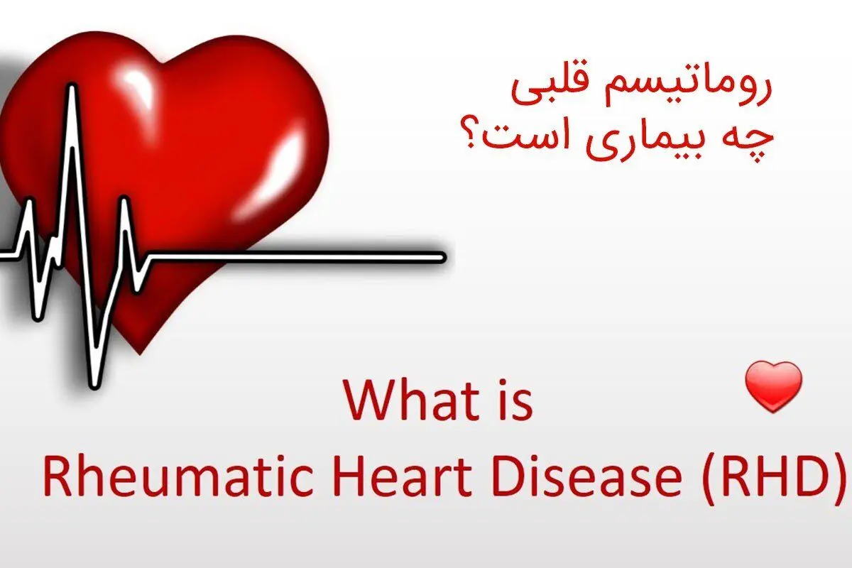 ۷ نشانه رماتیسم قلبی و روش پیشگیری 