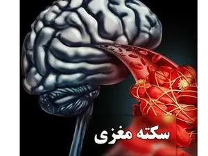 سردردها را جدی بگیرید / بروز تدریجی علایم سکته مغزی