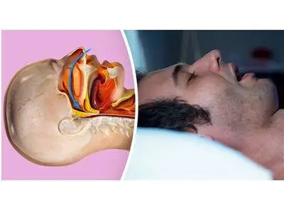 ۷ راهکار  برای خلاص شدن از خروپف (راهکارهای ساده)