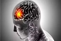 این چربی مغز شما را نابود می‌کند