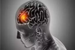 این چربی مغز شما را نابود می‌کند