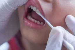 استرس چگونه دندان‌ های شما را نابود می‌کند؟