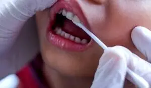 استرس چگونه دندان‌ های شما را نابود می‌کند؟