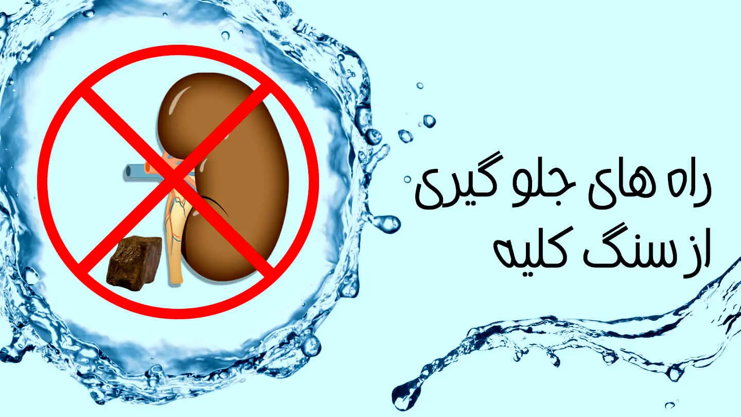 توصیه غذایی برای پیشگیری از سنگ کلیه