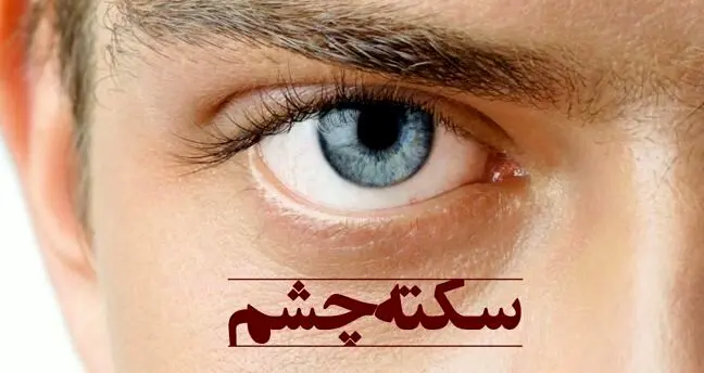«سکته چشمی» چیست؟
